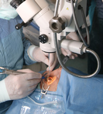 oog chirurgie