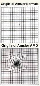 Amsler grids