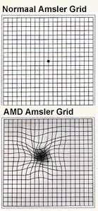 Amsler grids