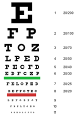 diagrama de snellen